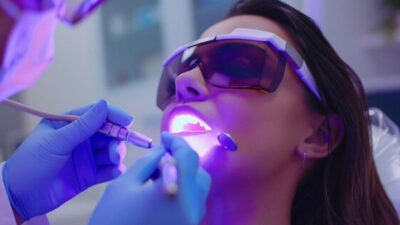 Lasers in Dentistry