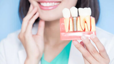 What Makes Dental Implants a Durable Option for Tooth Replacement in Rolla