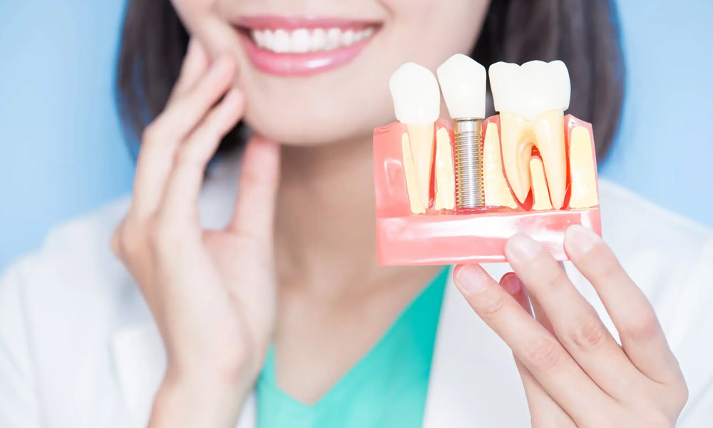 What Makes Dental Implants a Durable Option for Tooth Replacement in Rolla
