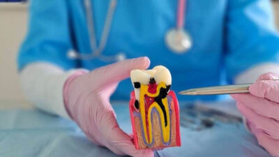 Why Root Canal Therapy Is Often the Best Solution for Tooth Pain in Kelowna