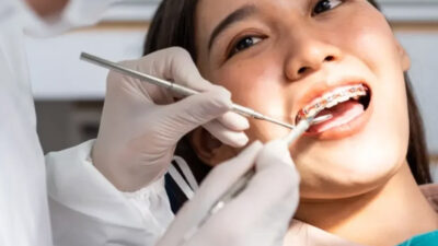 Key Factors Orthodontists in Brookhaven Assess Before Recommending Braces
