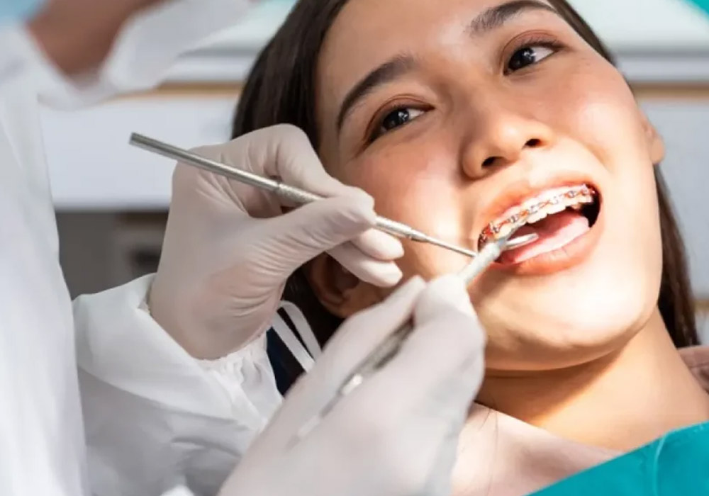 Key Factors Orthodontists in Brookhaven Assess Before Recommending Braces