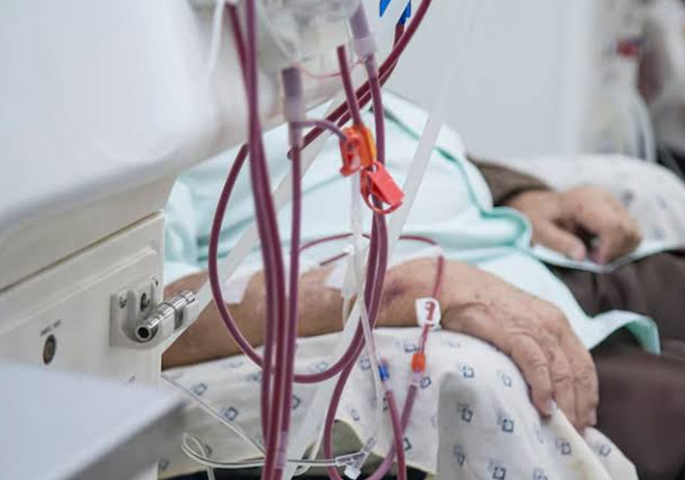 Key Features To Compare Before Buying A Pre Owned Dialysis Machine