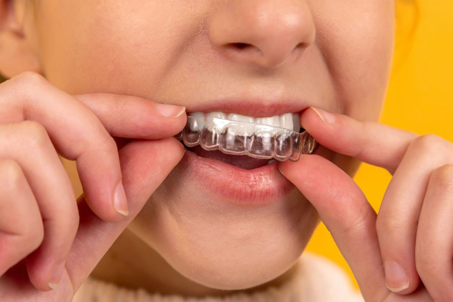 How Nova Orthodontics Helps Mukilteo Patients Decide If Invisalign Is Right for Them